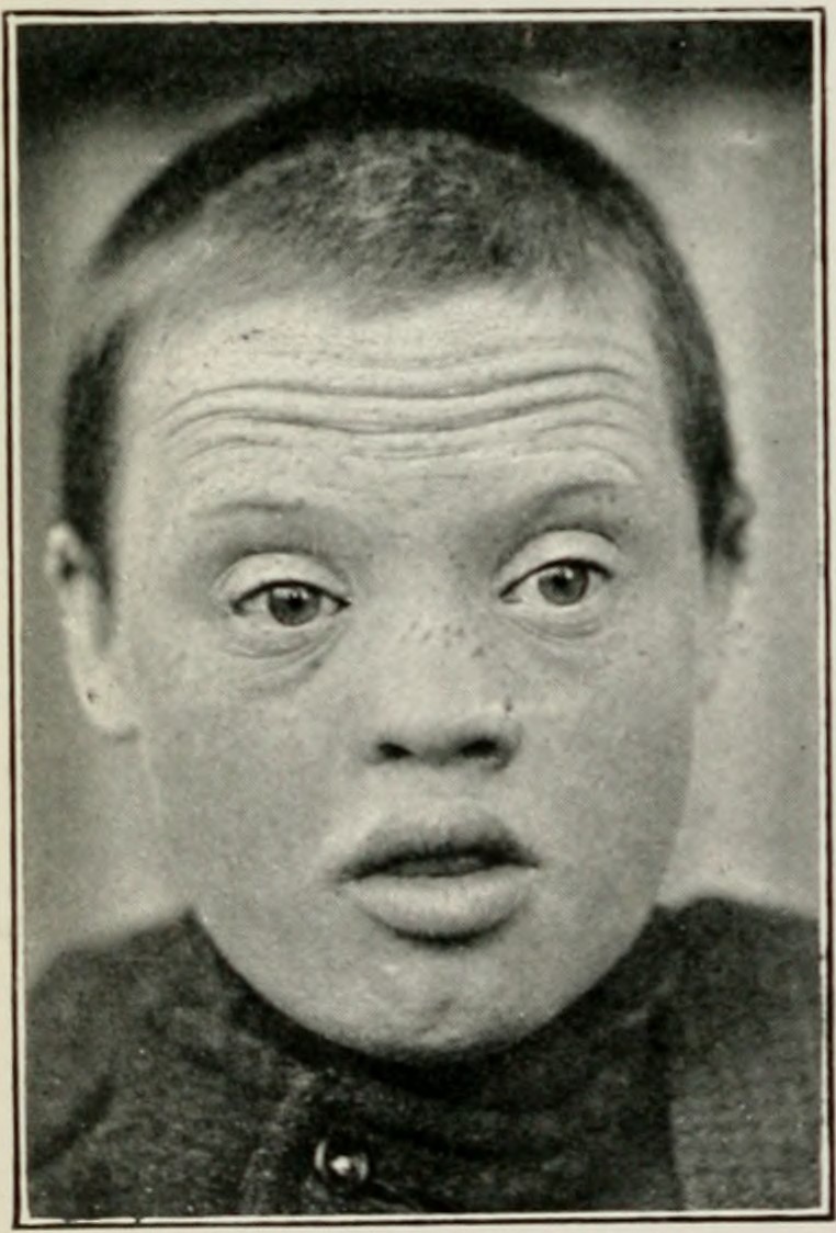 Amentia_Plate_XIII_(3).jpeg