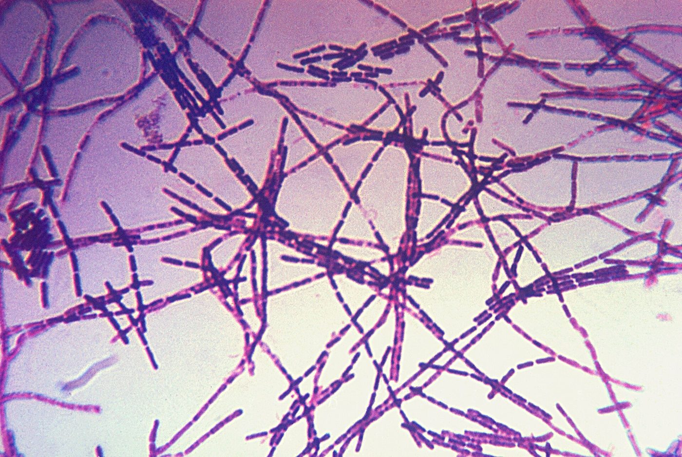 Fotografía al microscopio de bacterias en forma de bastón teñidas de morado, formando cadenas largas