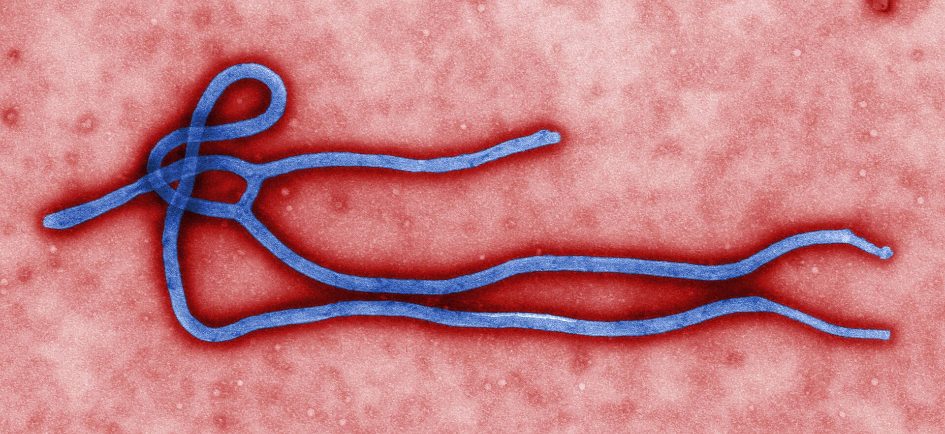 Imagen de microscopio electrónico de un virus alargado con forma de filamento enroscado, coloreada en tonos verdes