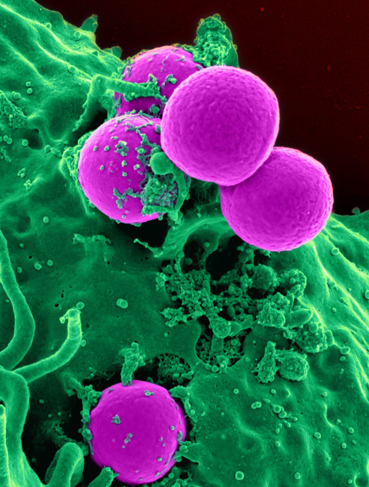 Imagen de microscopio electrónico de un glóbulo blanco grande y rugoso que envuelve varias bacterias redondas más pequeñas