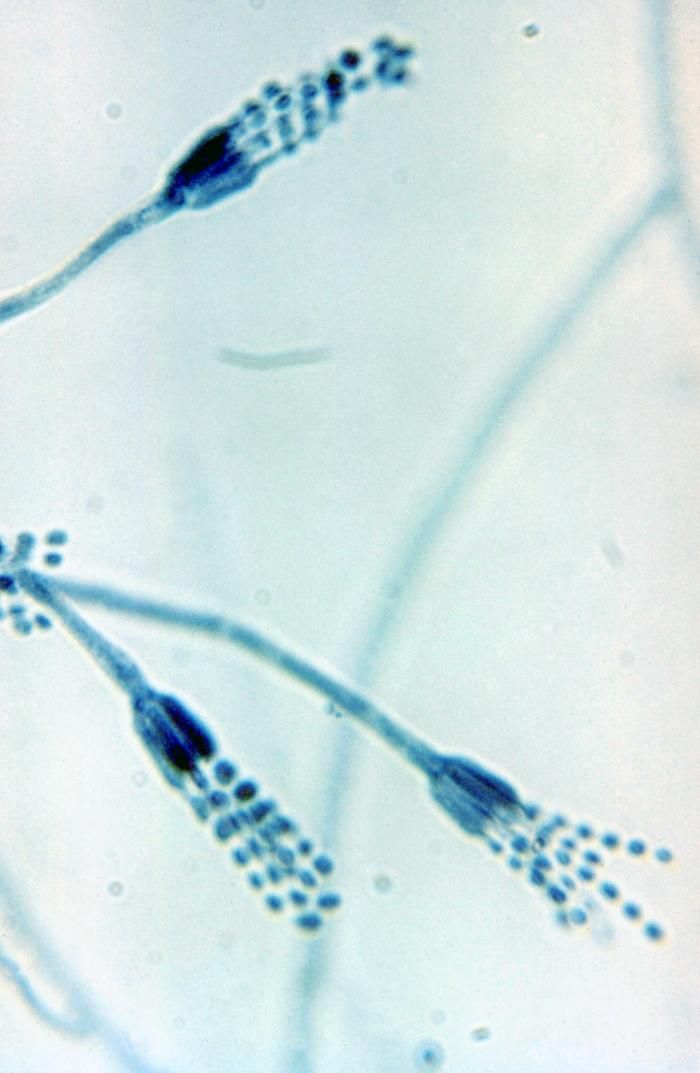 Fotografía al microscopio de un moho con ramificaciones en forma de pincel de las que cuelgan esporas
