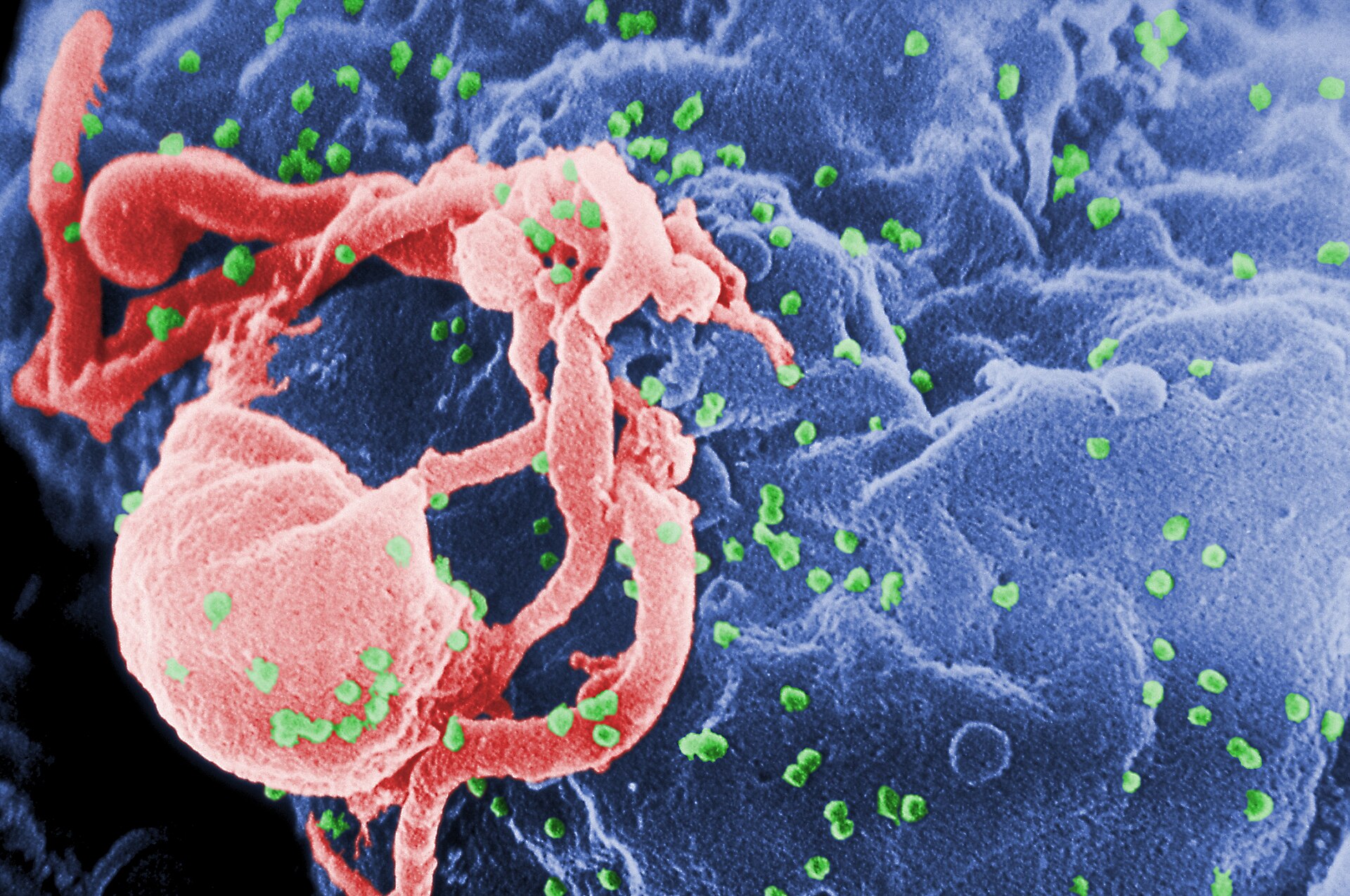 Imagen de microscopio electrónico de una célula de la que brotan muchas partículas redondas pequeñas, coloreadas en verde