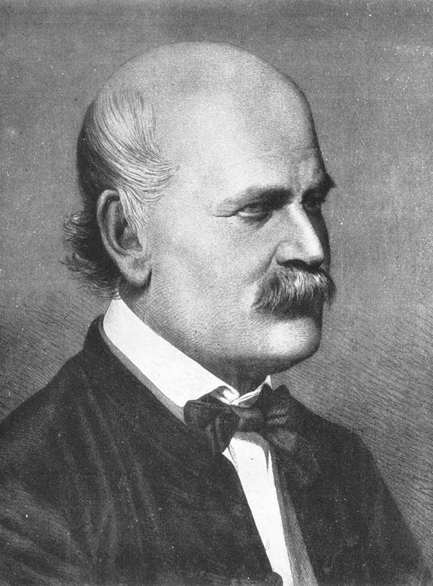Grabado de Ignaz Semmelweis de medio cuerpo, con bigote y levita